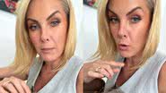 Ana Hickmann deu detalhes do estado de saúde de um de seus cachorros - Reprodução/Instagram