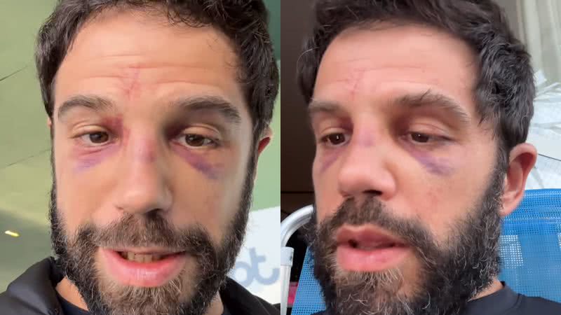 Duda Nagle falou sobre a situação de seu rosto ao retornar na academia - Reprodução/Instagram