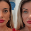 Andressa Urach sofre após mudar a cor dos olhos e médico faz alerta grave