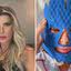 Íris Stefanelli compartilhou primeiros resultados do lifting facial nesta quinta-feira (19)