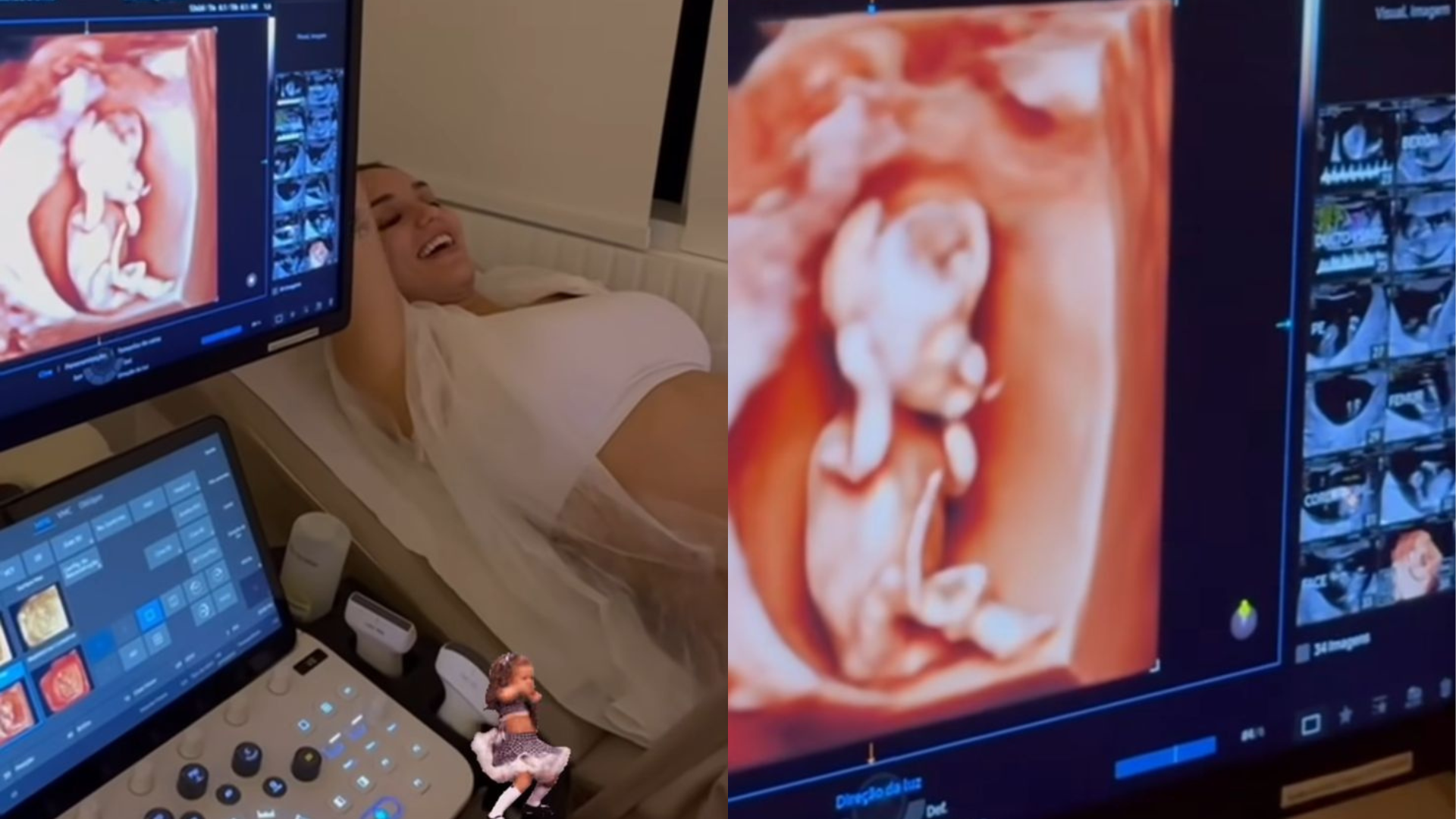 Nattan emociona ao mostrar ultrassom da filha com Rafa Kalimann pela 1ª vez